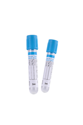 FSC de Blauwe GLB 2-5ml van de het Bloedinzameling van het Natriumcitraat Buizen van de Buis Plastic Vacuum
