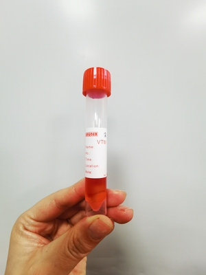 Rode van de het Specimenzwabber van GLB 10ml het Vervoerbuis met 3ml-Oplossing