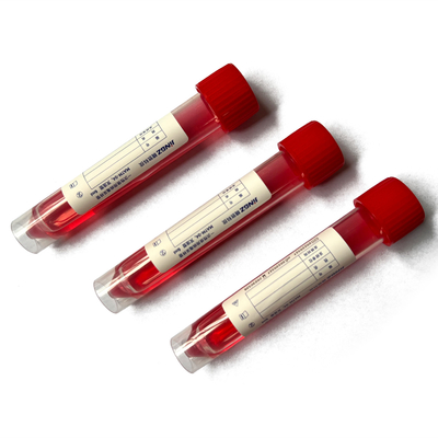Rode van de het Specimenzwabber van GLB 10ml het Vervoerbuis met 3ml-Oplossing