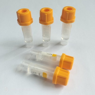 0.25ml-1ml van de de Inzamelingsbuis van het kind de niet Vacuümbloed Buizen van het GelVacuum
