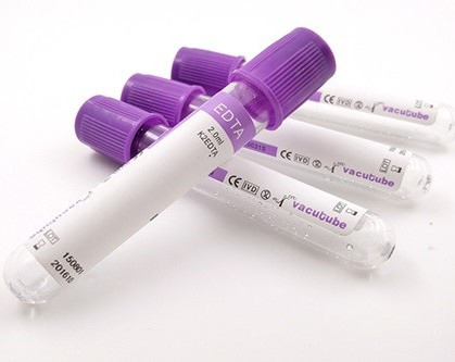 Het EDTAbuis van JINGZ 0.5ml-10ml K2 voor Bloedonderzoekvacuüm volgens Hoogte