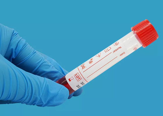 Beschikbare 10ml-Virusbemonstering Kit Nucleic Acid Extraction Kit