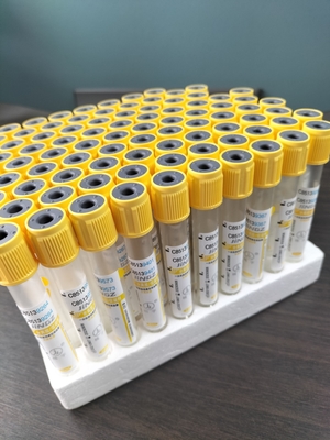 Gele bovenkant Steriele gel bloedstolling activator SST Vacuüm bloedmonsteringsbuis Voor ziekenhuis