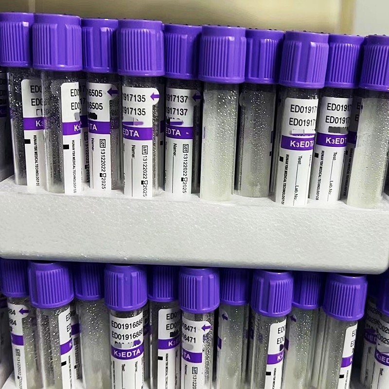 Vacuümbuis 12/18 van het EDTAbloedmonster Rekken per Karton3.2mg/ml Additief