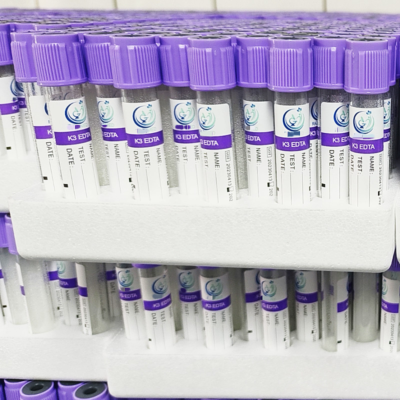 Purpere van het het EDTAbloed van GLB Vacuüm van de de Inzamelingsbuis K3 het EDTA3.2mg/ml Plastic Reageerbuis
